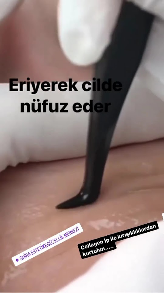 Shira Estetik&Güzellik Merkezi