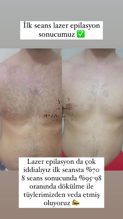 Hazal Babalık Beauty Antalya