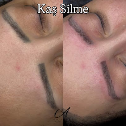 Aysel Çetinalp Kadıköy İğneli Epilasyon & Lazer Epilasyon