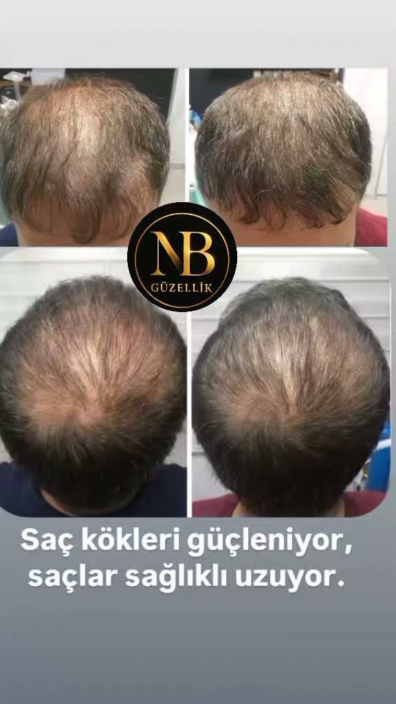 GÜZELLİK SALONU Aksaray