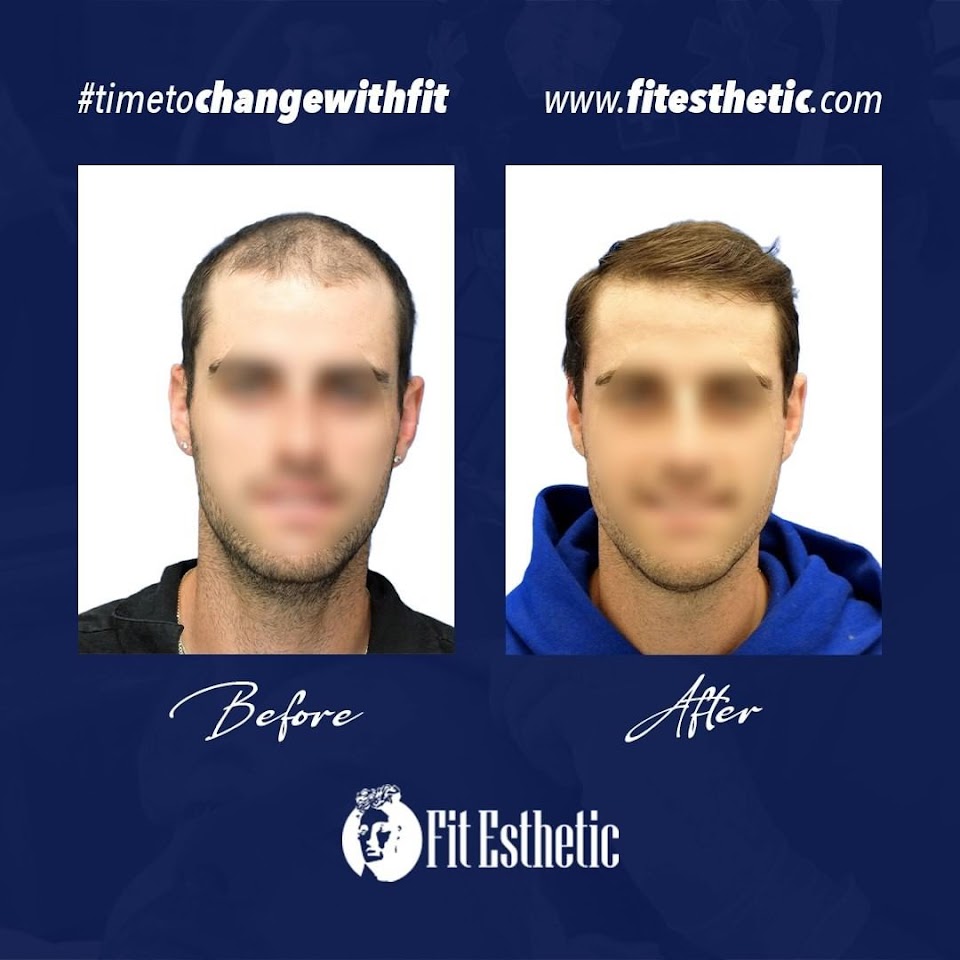 Fit Esthetic İstanbul Saç ve Estetik Merkezi