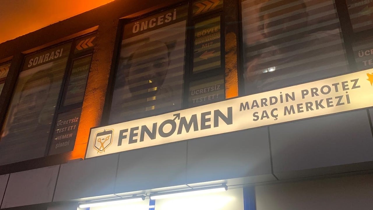 Fenomen protez saç Mardin