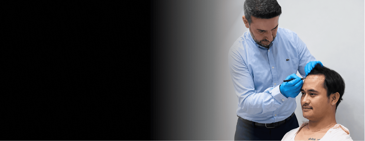 Best Hair Transplant Istanbul Turkey Grace Touch Clinic