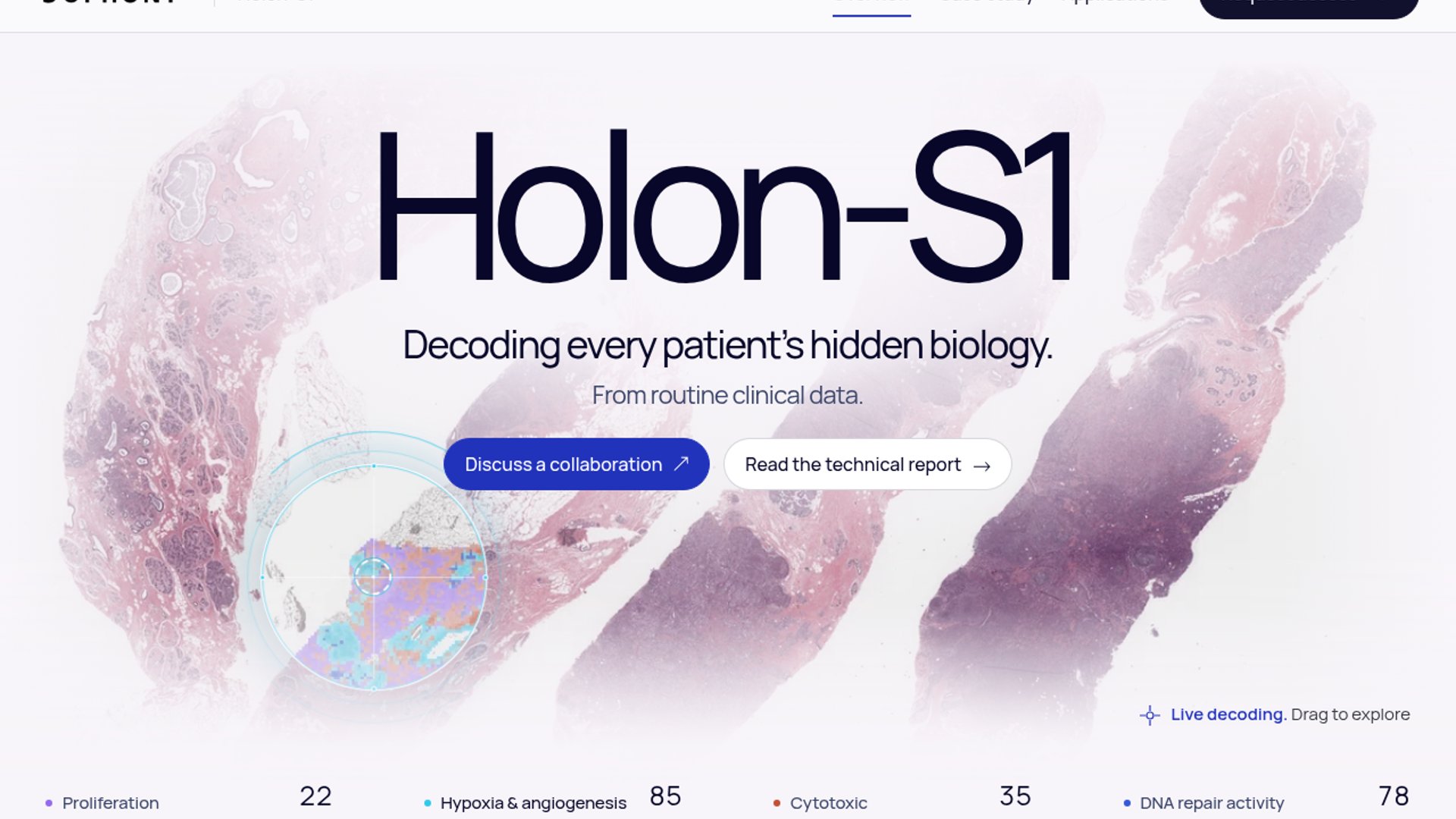 Sophont Launches Holon-S1 for Spatial Biology