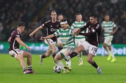 Hearts vs Celtic