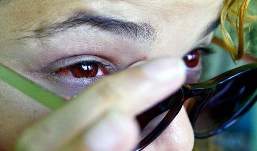 Conjuntivitis en Cuba. Foto: Alba León Infante
