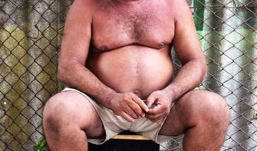 Obesidad en Cuba. Foto: Alba León Infante