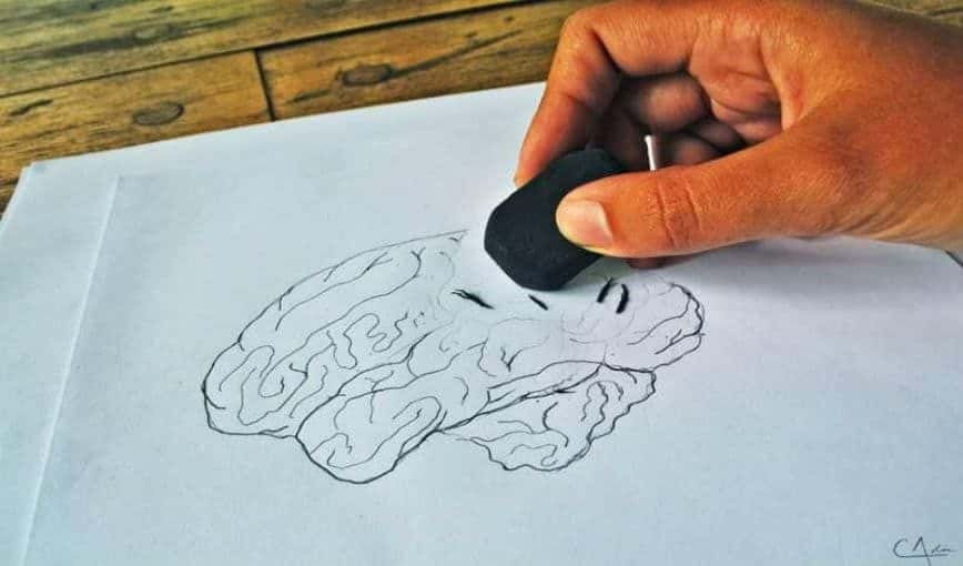 Alzheimer
