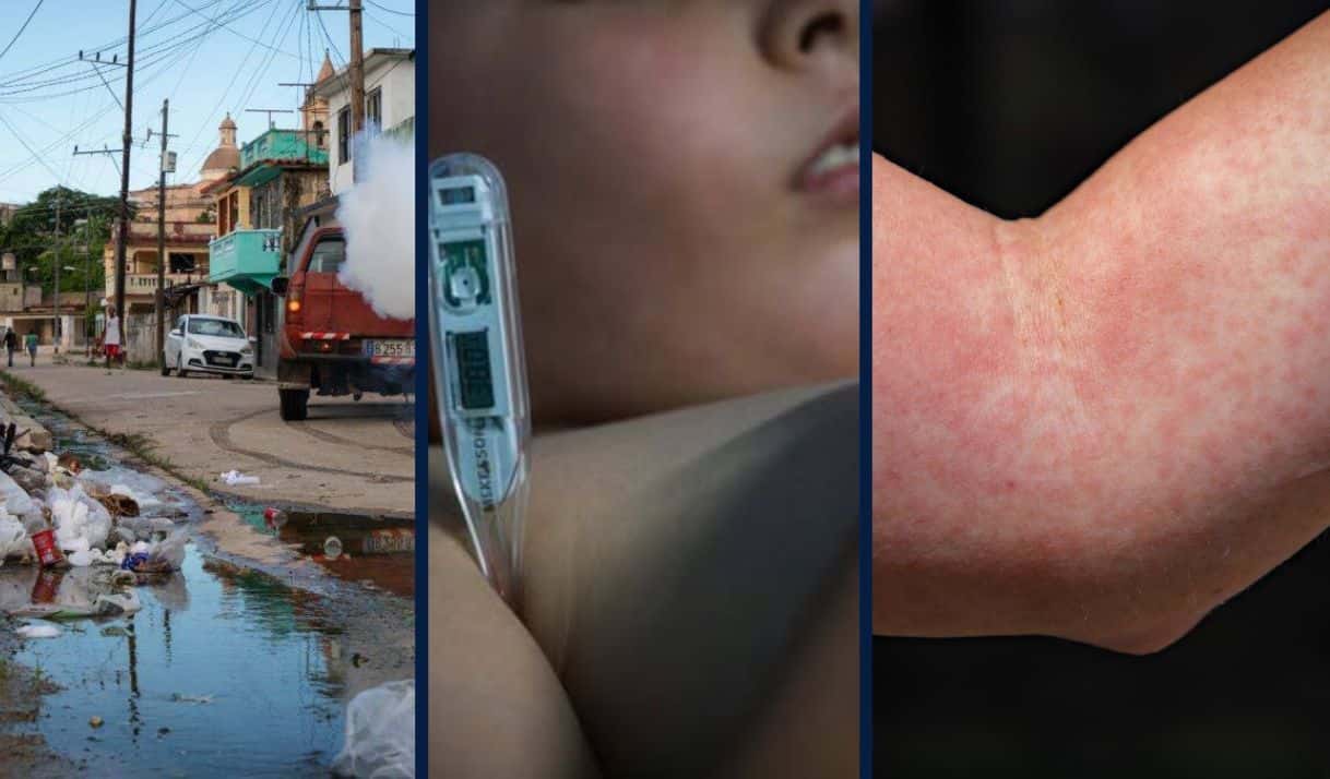 arbovirosis_Cuba.jpg