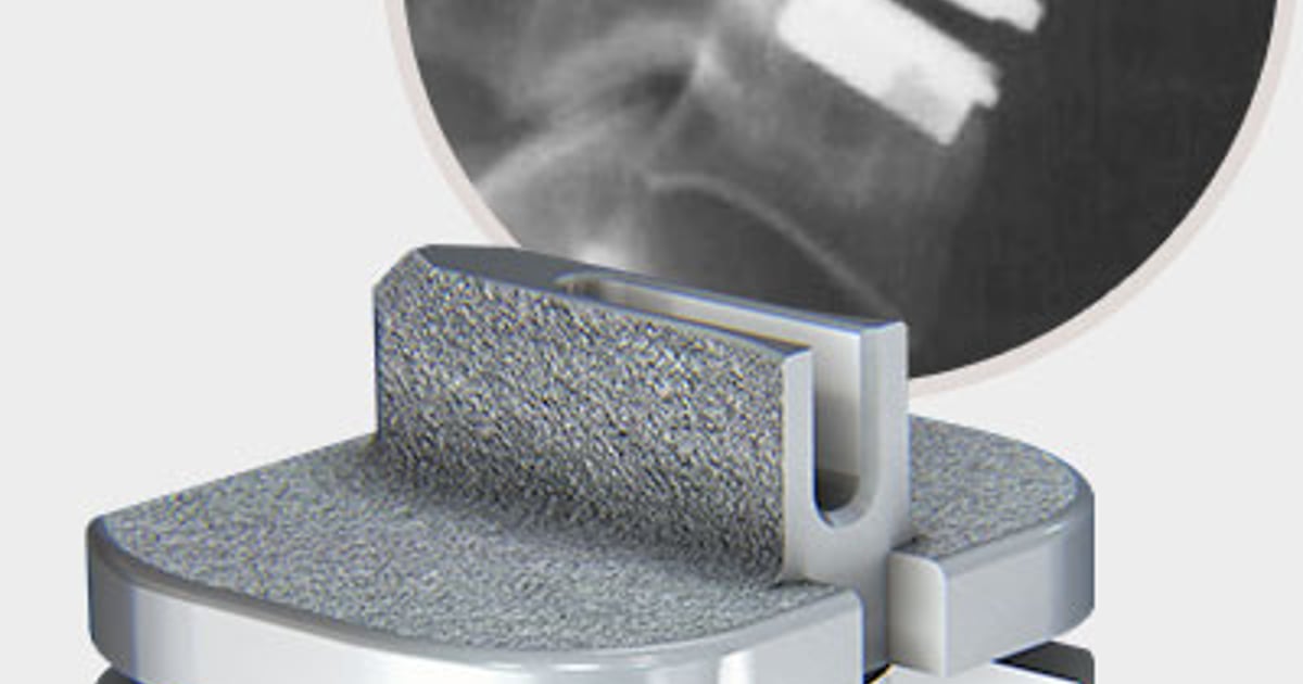 prodisc C implant with fluoroscopy inset
