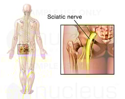 Sciatic Nerve