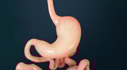 Tratamientos para la obesidad: Medicamentos y procedimientos quirúrgicos bariátricos