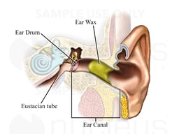 Ear Wax