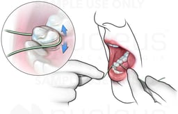 Flossing Your Teeth
