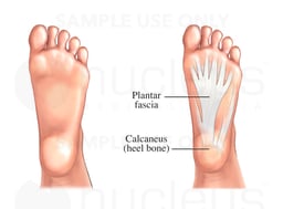 Foot - Plantar Fascia Ligament