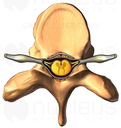 Thoracic Vertebra with Spinal Cord, Superior View