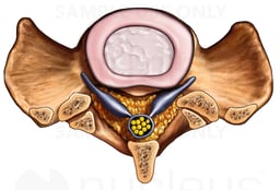 Sacrum with Intervertebral Disc and Nerves, Superior View