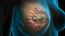 Breast Anatomy with Internal Lump