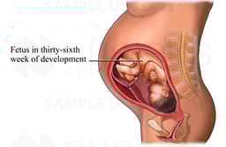 Normal Pregnancy: Third Trimester
