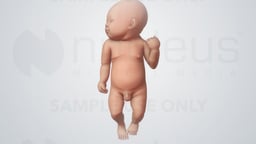 Newborn Circumcision