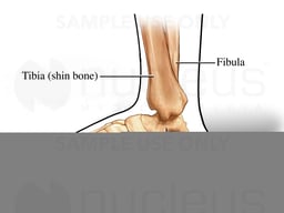 Medial (Side) View of Ankle