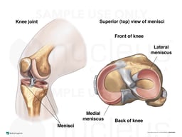 Normal Knee Joint Cartilages (Meniscus, Menisci)