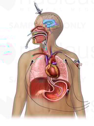 Medical Treatment - Devices