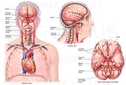 Arteries of the Brain