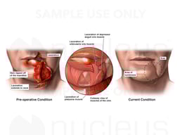 Injuries to Face and Neck