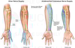 Cutaneous Nerve Supply to the Right Arm, Wrist and Hand