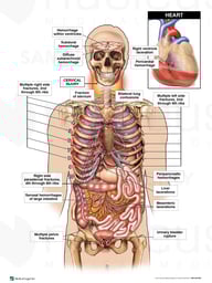 General Body Injuries