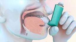 How to Use a Metered-Dose Inhaler
