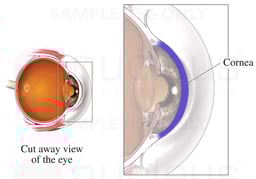 Cornea of the Eye