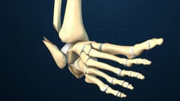 Ankle Fracture Repair