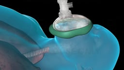Delivery of Oxygen and Anesthetic Gas