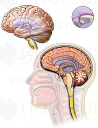 Intracranial Circulation of Cerebrospinal Fluid (CSF)