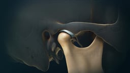 Temporomandibular Joint (TMJ) Anatomy