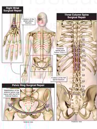Multiple Surgical Repairs