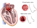Aortic Valve: Open and Closed