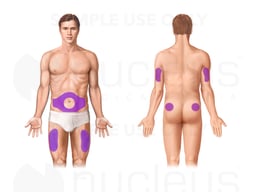 Insulin Injection Sites