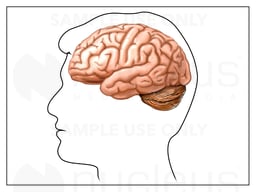 Brain: Lateral View