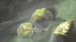 Cholecystectomy (Gallbladder Removal)