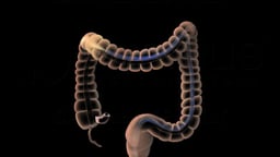 Lower GI Endoscopy (Sigmoidoscopy or Colonoscopy)