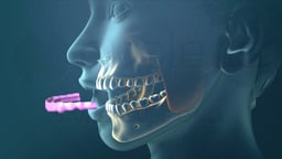 Nonsurgical Treatments for TMJ Disorders (TMD)