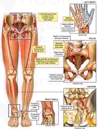 Multiple Traumatic Injuries