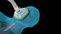 Face Mask for Oxygen and Anesthetic Gas Delivery