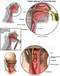 Anatomy of the Piriform Recess