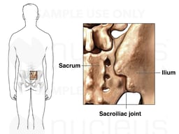 Sacroiliac Joint: Posterior (Back) View, Male