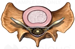 Sacrum with Intervertebral Disc and Nerves, Superior View