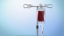Treatment for Sickle Cell Anemia